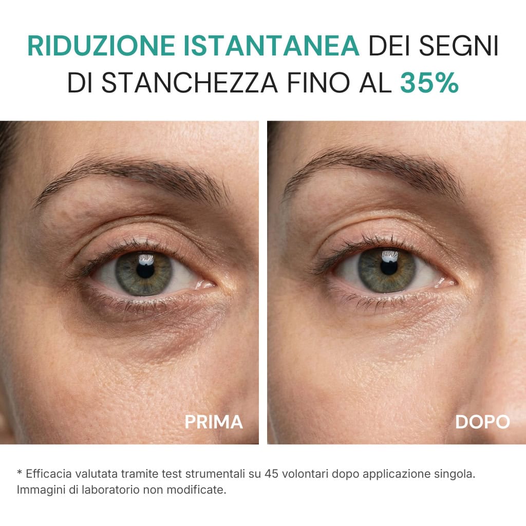 Crema Borse e Occhiaie - Image 3