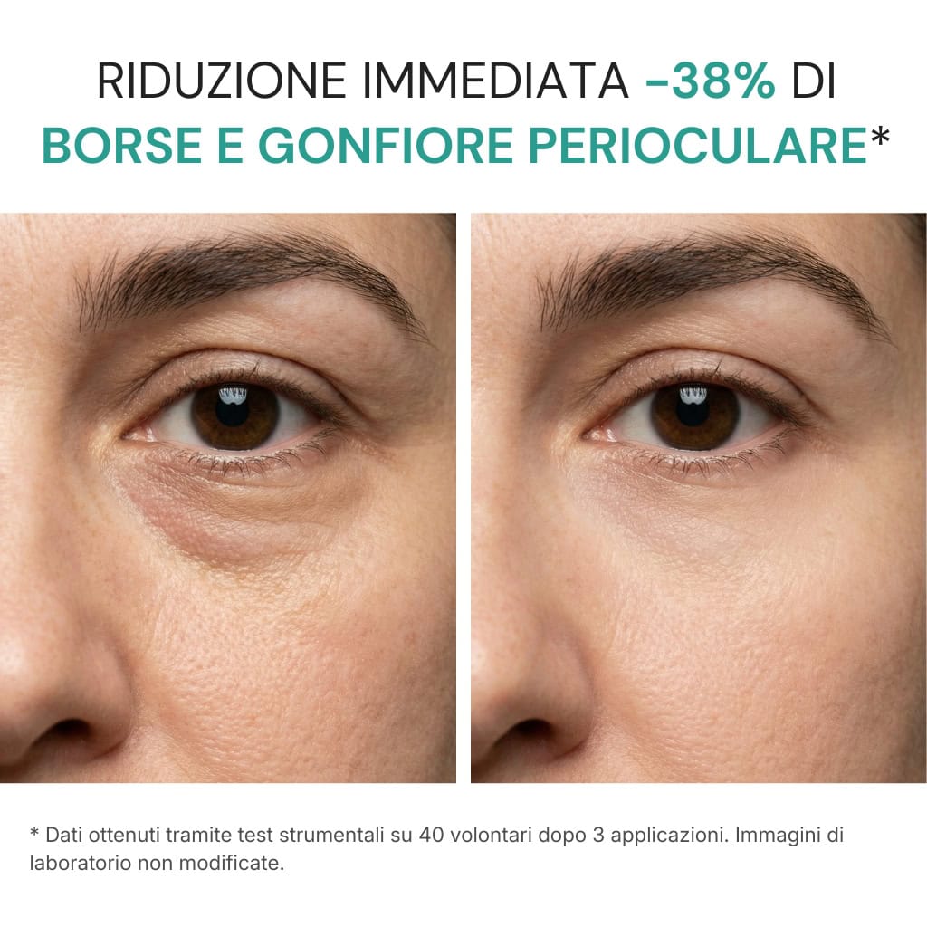 Crema Contorno Occhi - Image 2