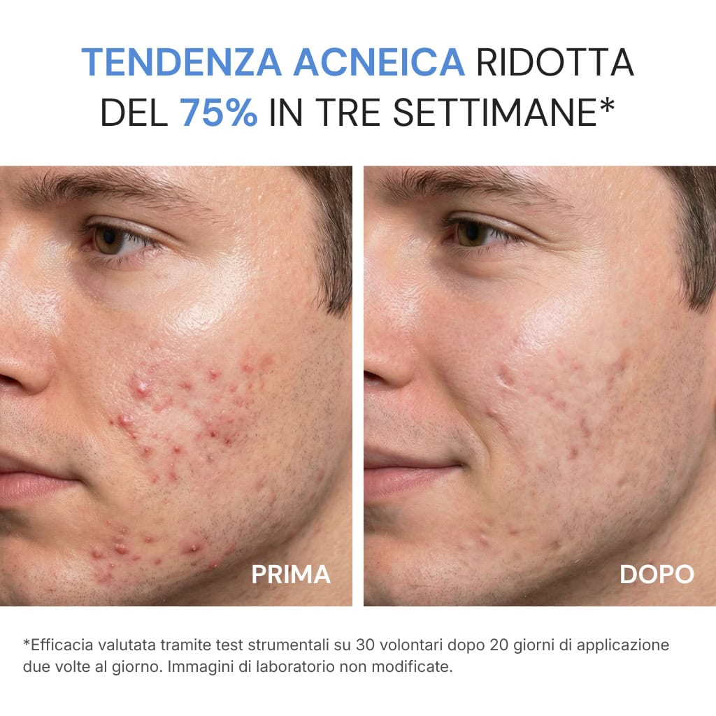 Crema Viso Acne Defence - Image 2