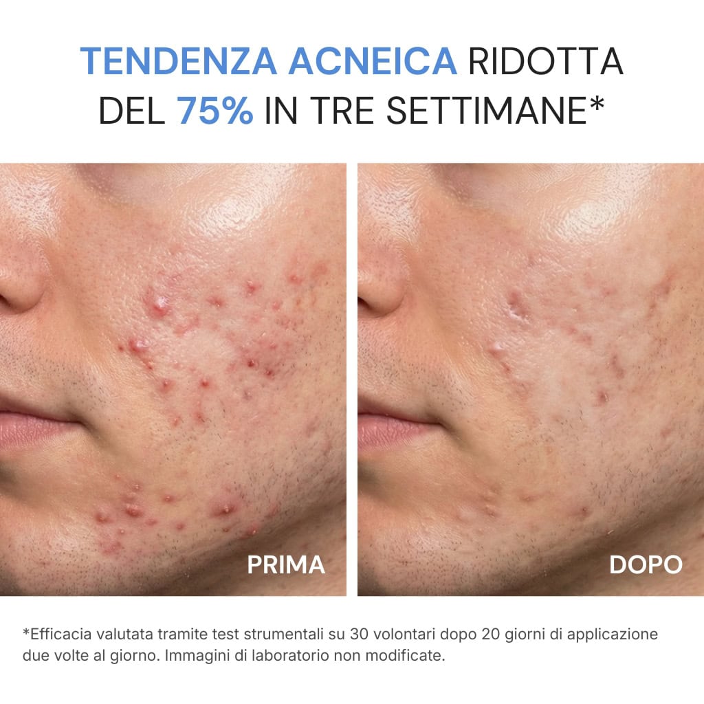 Crema Viso Acne Defence - Image 3