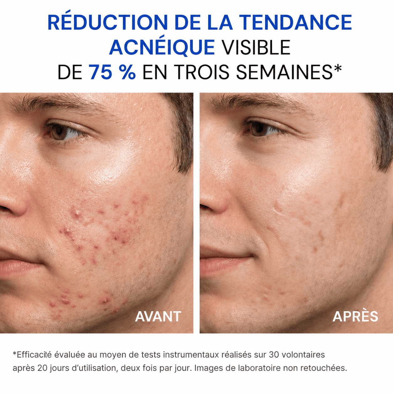 Crema Viso Acne Defence - Image 2