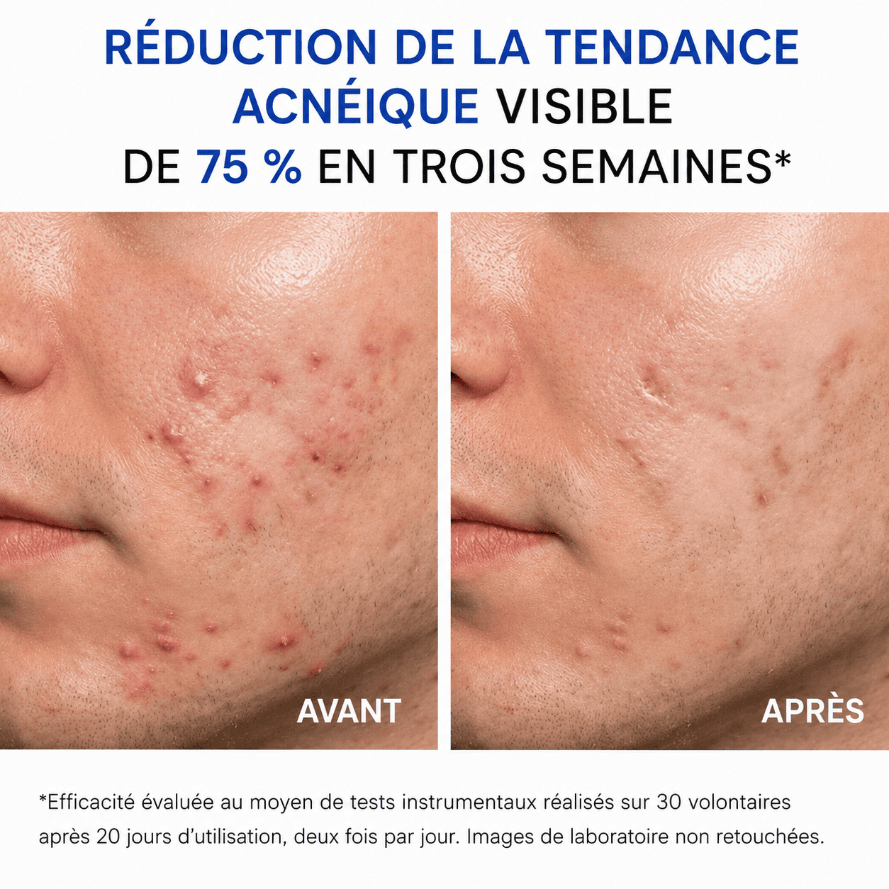 Crema Viso Acne Defence - Image 3